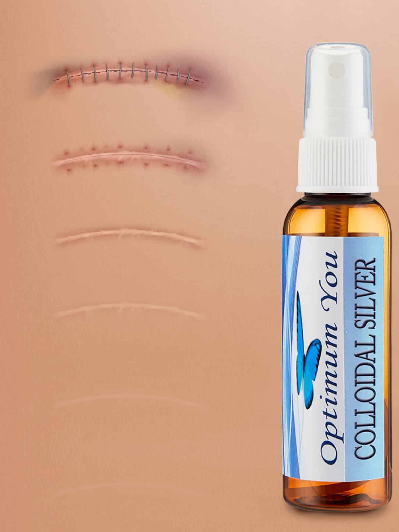 Optimum You Colloidal Silver helps healing occur faster!